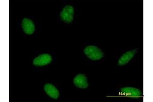 Immunofluorescence of purified MaxPab antibody to PTS on HeLa cell. (PTS antibody  (AA 1-145))