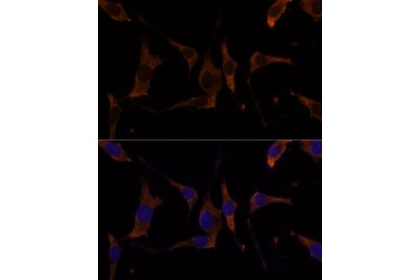 RPL7A antibody  (AA 1-266)