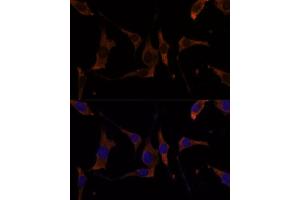 Immunofluorescence analysis of L929 cells using RPL7A Polyclonal Antibody (ABIN6128657, ABIN6147150, ABIN6147152 and ABIN6217809) at dilution of 1:100 (40x lens). (RPL7A antibody  (AA 1-266))