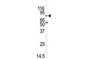 Western blot analysis of MARK2 antibody and mouse thymus tissue lysate (MARK2 antibody  (AA 600-630))