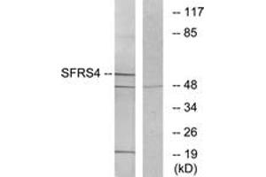 Western blot analysis of extracts from LOVO cells, using SFRS4 Antibody.