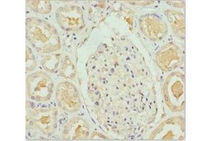 Immunohistochemistry of paraffin-embedded human kidney tissue using ABIN7144769 at dilution of 1:100 (PEA15 antibody  (AA 1-130))