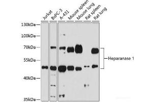 Western blot analysis of extracts of various cells using Heparanase 1 Polyclonal Antibody at dilution of 1:1000. (HPSE antibody)
