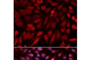 Immunofluorescence analysis of U2OS cells using SDCBP Polyclonal Antibody (SDCBP antibody)