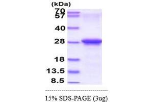 SDS-PAGE (SDS) image for Coxsackie Virus and Adenovirus Receptor (CXADR) (AA 20-237) protein (His tag) (ABIN5853079) (Coxsackie Adenovirus Receptor Protein (AA 20-237) (His tag))