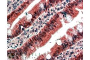 Immunohistochemistry (IHC) image for anti-Fibroblast Growth Factor Receptor 1 (FGFR1) (C-Term) antibody (ABIN185351)
