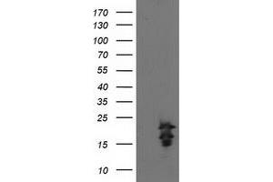 Western Blotting (WB) image for anti-Fibroblast Growth Factor 21 (FGF21) antibody (ABIN1498256) (FGF21 antibody)