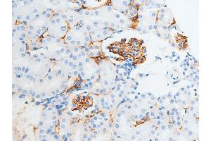 Immunohistochemistry (IHC) image for anti-Checkpoint Kinase 2 (CHEK2) (pSer516) antibody (ABIN6255391)