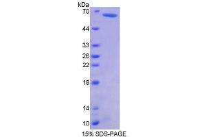 SDS-PAGE (SDS) image for Geminin, DNA Replication Inhibitor (GMNN) (AA 1-209) protein (His tag,GST tag) (ABIN6238666)