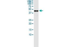 Immunoprecipitation of MVD transfected lysate using rabbit polyclonal anti-MVD and Protein A Magnetic Bead ( U0007 ), and immunoblotted with mouse purified polyclonal anti-MVD. (MVD (Human) IP-WB Antibody Pair)