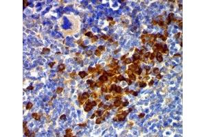 IHC testing of mouse spleen stained with CD63 antibody (MX49. (CD63 antibody)