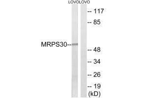 Western blot analysis of extracts from LOVO cells, using MRPS30 antibody. (MRPS30 antibody  (C-Term))