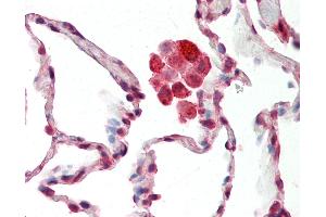 Anti-NDUFS8 antibody IHC staining of human lung. (NDUFS8 antibody  (C-Term))