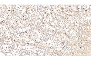 Detection of DUSP3 in Human Spinal cord Tissue using Monoclonal Antibody to Dual Specificity Phosphatase 3 (DUSP3) (Dual Specificity Phosphatase 3 (DUSP3) (AA 2-185) antibody)