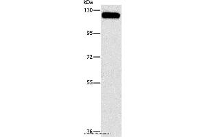 Western blot analysis of 231 cell, using CBL Polyclonal Antibody at dilution of 1:750 (CBL antibody)