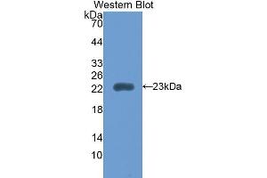 Western Blotting (WB) image for anti-Retinol Binding Protein 5, Cellular (RBP5) (AA 19-201) antibody (ABIN1860414) (Retinol Binding Protein 5 antibody  (AA 19-201))