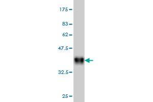 Western Blotting (WB) image for anti-Adenylate Cyclase Activating Polypeptide 1 (Pituitary) Receptor Type I (ADCYAP1R1) (AA 21-120) antibody (ABIN559786)