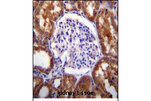 SLC12A6 Antibody (N-term) (ABIN656316 and ABIN2845619) immunohistochemistry analysis in formalin fixed and paraffin embedded human kidney tissue followed by peroxidase conjugation of the secondary antibody and DAB staining. (SLC12A6 antibody  (N-Term))