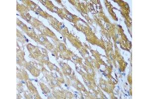 Immunohistochemistry of paraffin-embedded Human liver using IGF2BP3 Polyclonal Antibody at dilution of 1:100 (40x lens).