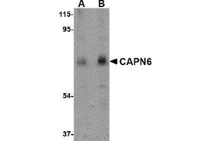 Western Blotting (WB) image for anti-Calpain 6 (CAPN6) (C-Term) antibody (ABIN1030308) (Calpain 6 antibody  (C-Term))