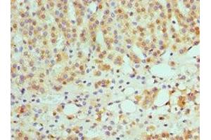Immunohistochemistry of paraffin-embedded human adrenal gland tissue using ABIN7145593 at dilution of 1:100 (SULT2A1 antibody  (AA 1-145))