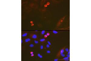 Immunofluorescence analysis of U-2 OS cells using T Rabbit mAb (ABIN7270916) at dilution of 1:100 (40x lens). (TACC3 antibody)