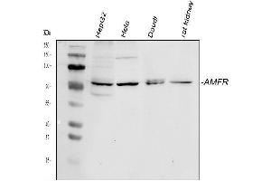 Western blot analysis of AMFR using anti-AMFR antibody (ABIN4886455). (AMFR antibody  (AA 553-643))