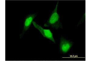 Immunofluorescence of monoclonal antibody to DPYSL2 on HeLa cell. (DPYSL2 antibody  (AA 470-571))