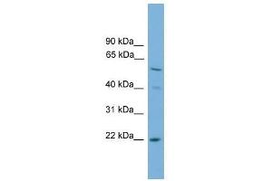 Western Blot showing UBE2T antibody used at a concentration of 1-2 ug/ml to detect its target protein.