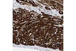 Immunohistochemical staining (Formalin-fixed paraffin-embedded sections) of human heart muscle with DES polyclonal antibody  shows strong cytoplasmic positivity in myocytes. (Desmin antibody)