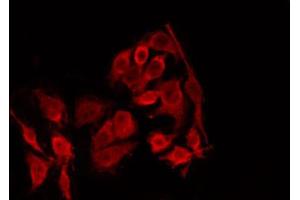 ABIN6269130 staining MCF7 by IF/ICC. (Bcl-2 antibody)