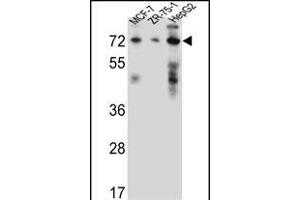 HSD17B4 Antibody (Center) (ABIN656447 and ABIN2845732) western blot analysis in MCF-7,ZR-75-1,HepG2 cell line lysates (35 μg/lane). (HSD17B4 antibody  (AA 341-370))