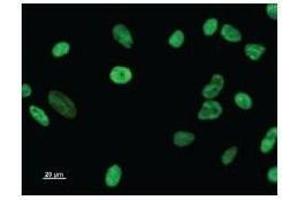 Immunostaining analysis in HeLa cells. (DDX17 antibody)