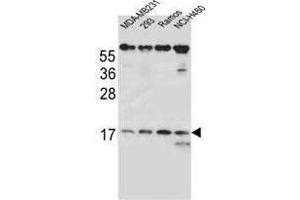 Western Blotting (WB) image for anti-T Cell Receptor beta Chain (TCRb) (AA 74-102), (Middle Region) antibody (ABIN955132)