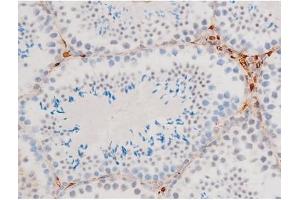 Immunohistochemistry (IHC) image for anti-GATA Binding Protein 4 (GATA4) (pSer105) antibody (ABIN6256094)