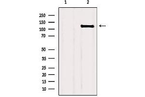 Western Blotting (WB) image for anti-Fibroblast Growth Factor Receptor 1 (FGFR1) (C-Term) antibody (ABIN6261731)