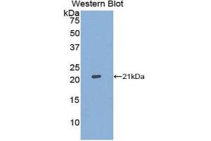 Western Blotting (WB) image for anti-Aconitase 1 (ACO1) (AA 26-189) antibody (ABIN1176781) (Aconitase 1 antibody  (AA 26-189))