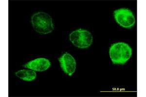 Immunofluorescence of purified MaxPab antibody to PTGES on HeLa cell.