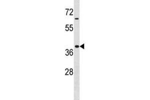 Hoxa9 antibody western blot analysis in MDA-MB453 lysate. (HOXA9 antibody  (AA 160-189))