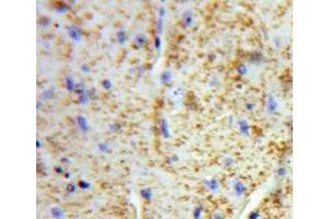 Used in DAB staining on fromalin fixed paraffin-embedded Brain tissue (VWA2 antibody  (AA 457-708))