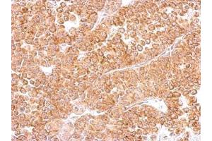 IHC-P Image DR3 antibody detects TNFRSF25 protein at cytosol on AGS xenograft by immunohistochemical analysis.