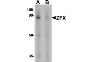 Western blot analysis of ZFX human small intestine tissue lysate with ZFX Antibody  at 1 ug/ml in (A) the absence and (B) the presence of blocking peptide. (ZFX antibody  (C-Term))
