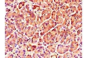 Immunohistochemistry of paraffin-embedded human pancreatic tissue using ABIN7173407 at dilution of 1:100 (TNRC6C antibody  (AA 157-421))