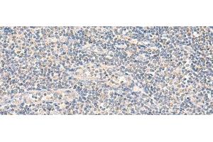 Immunohistochemistry of paraffin-embedded Human tonsil tissue using NEGR1 Polyclonal Antibody at dilution of 1:90(x200)