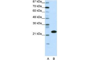 WB Suggested Anti-TAF11 Antibody Titration:  0. (TAF11 antibody  (N-Term))