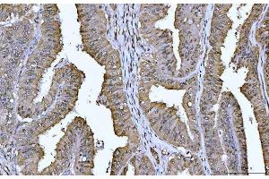 IHC analysis of YWHAE using anti-YWHAE antibody (ABIN7599165). (YWHAE antibody  (AA 1-255))