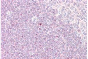 Immunohistochemistry (IHC) image for anti-Ribosomal Protein S6 Kinase, 90kDa, Polypeptide 1 (RPS6KA1) (AA 346-395) antibody (ABIN2878974)