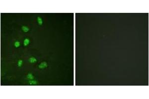 Immunofluorescence analysis of HeLa cells, using CHOP (Ab-30) Antibody. (DDIT3 antibody  (AA 15-64))