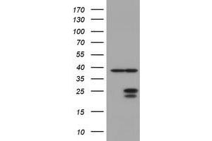 Image no. 1 for anti-Ubiquitin-Conjugating Enzyme E2E 3 (UBE2E3) antibody (ABIN1501623) (UBE2E3 antibody)