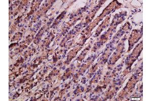 Formalin-fixed and paraffin embedded rat stomach labeled with Rabbit Anti-ATG9A Polyclonal Antibody, Unconjugated  at 1:200 followed by conjugation to the secondary antibody and DAB staining